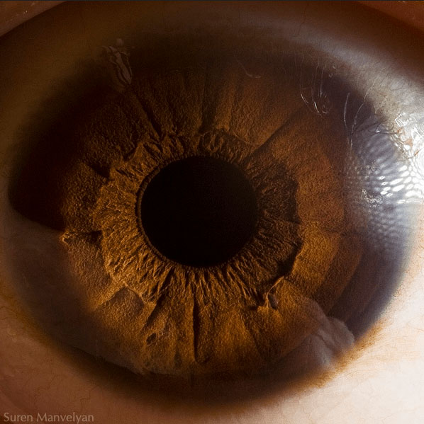 occhio-pupilla