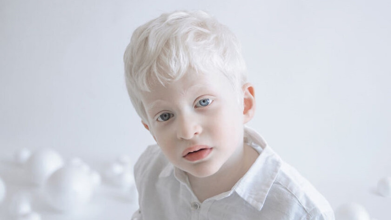 raccolta foto albini