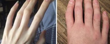caratteristiche fisiche uniche