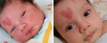 bimbo nato con voglia a forma di cuore