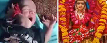 In india una bambina è nata con 26 dita